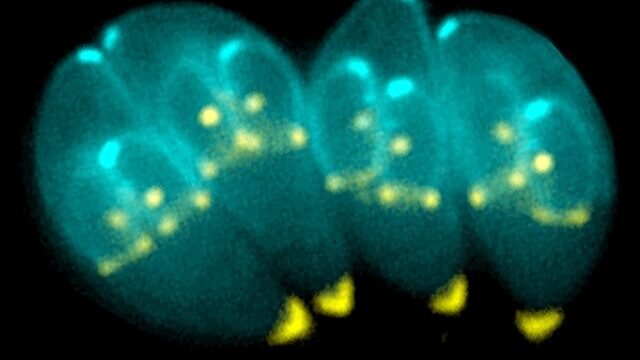 toxoplasma gondii