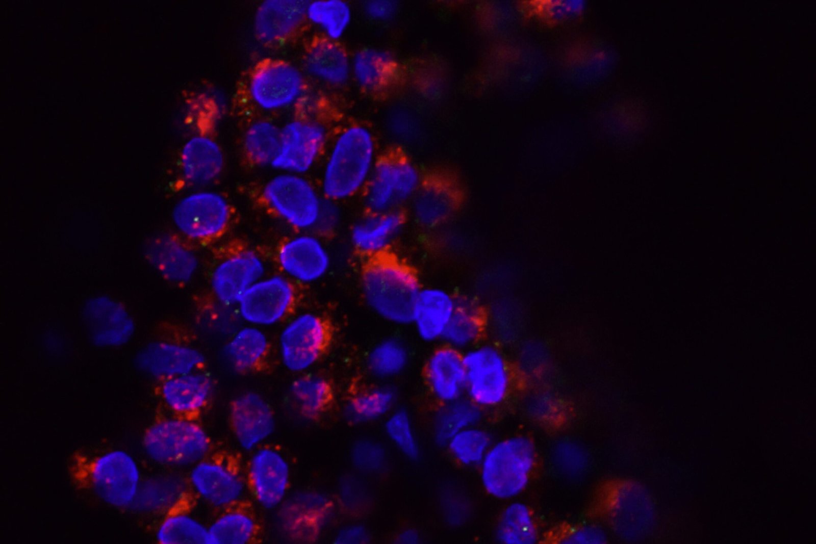 national cancer institute evhlgfoju5y unsplash