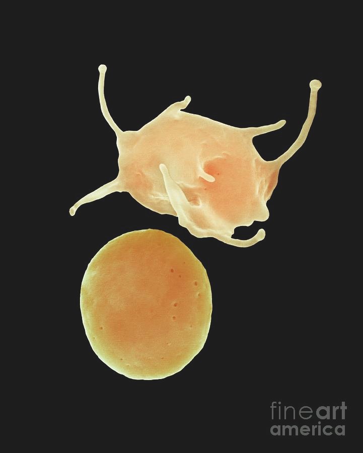How Blood Clots and Scabs Actually Work 11 activated and non activated platelets dennis kunkel microscopyscience photo library