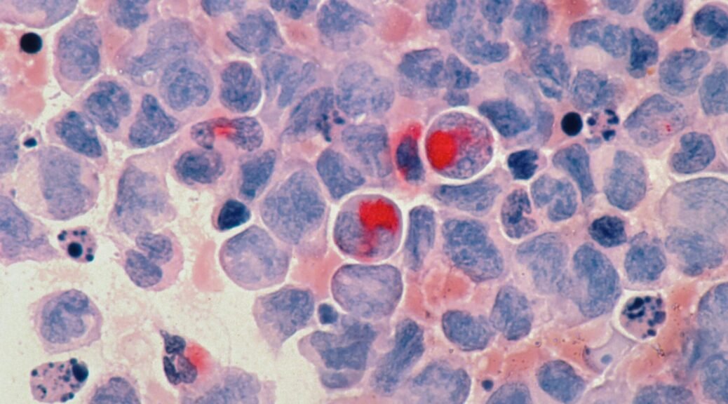 national cancer institute mbl91lg56zc unsplash